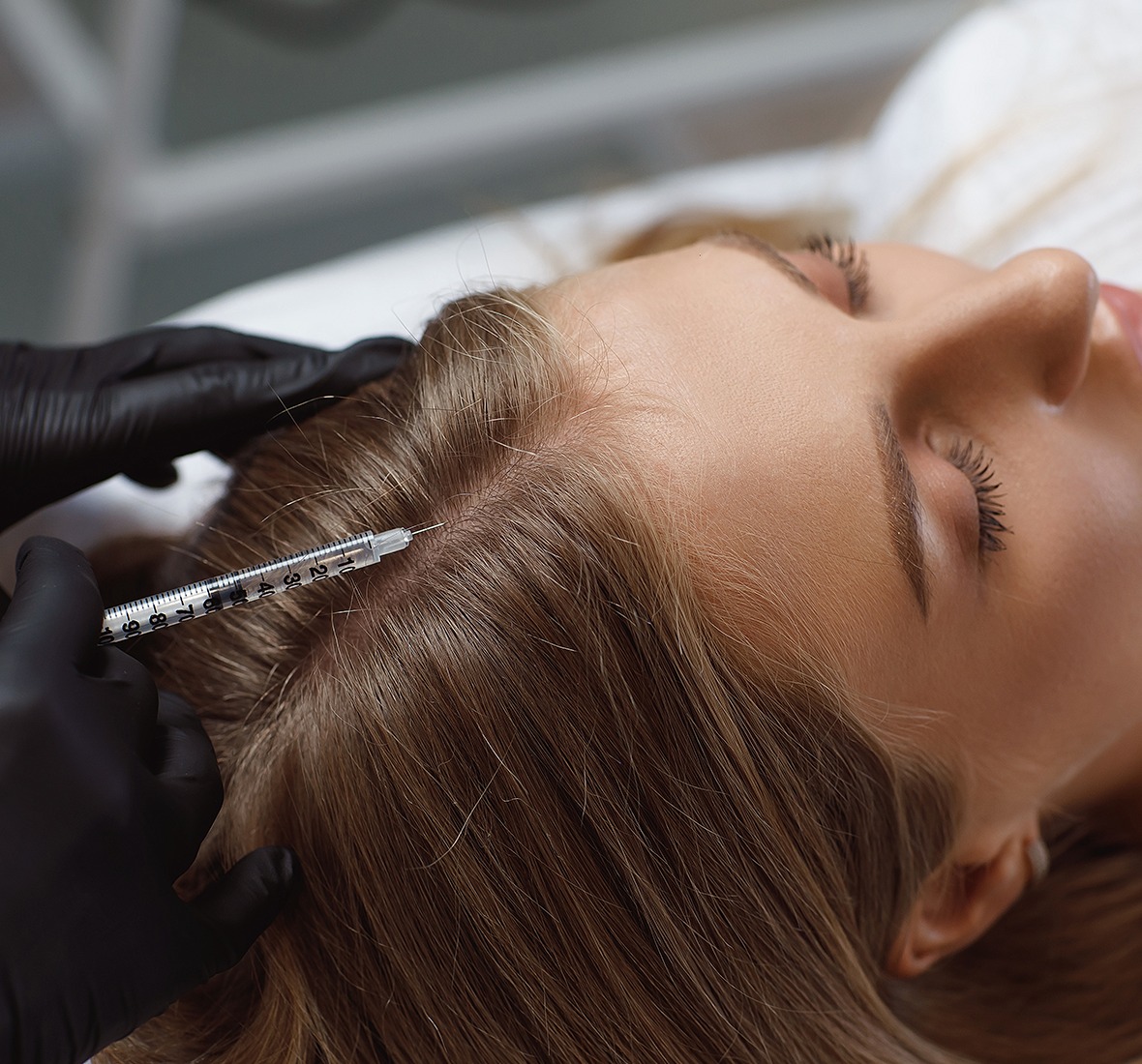 GFC treatment in hyderabad